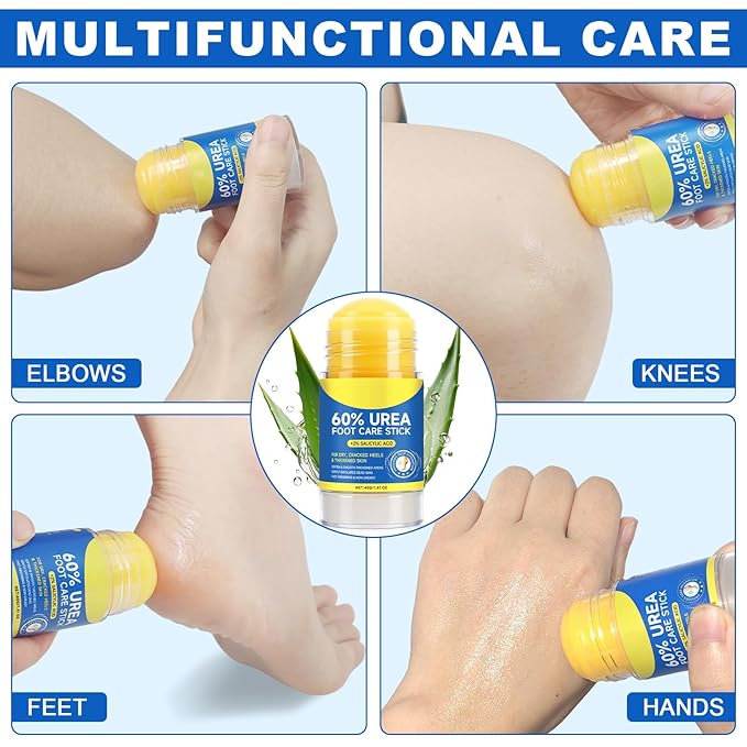 Urea Foot Cream with Salicylic Acid – Heel Stick for Cracked Feet, Repairs Dry Rough Heels Fast, Intensive Moisturizer for Dead Skin, Hydrating Heel Balm with Urea for Smooth -Looking Feet