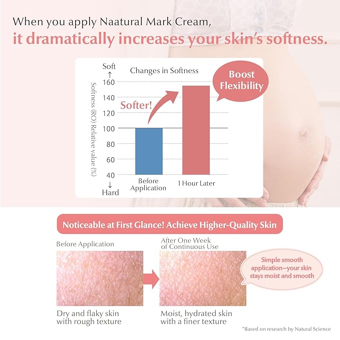Mama&Kids Natural Mark Cream 16.58 oz (470g), Stretch Mark Cream For Pregnancy, A moisture-rich cream, Pregnancy Skin Care