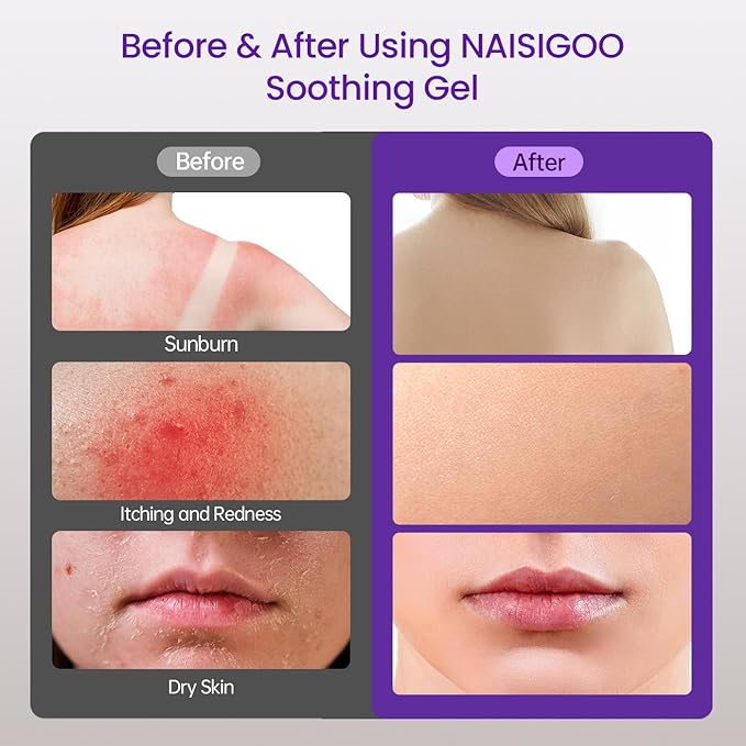 Aloe Vera Gel Soothes Skin for After IPL Laser Hair Removal Women Men in Face or Body, Travel Aloe Vera Gel for Sunburn Relief, Hydrate and Moisturize, Chamomile Extracts, 4.1 fl oz