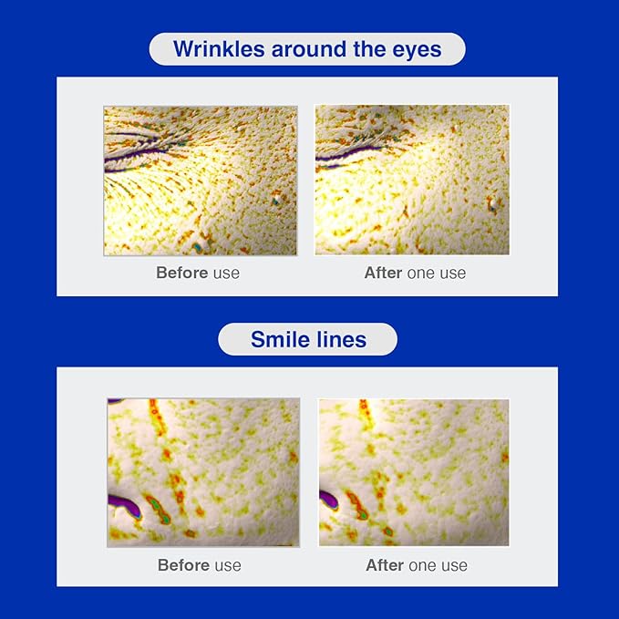 IOPE Retinol Serum in Deep Collagen Gel Mask 5+1 Set | Double-Layered Hydrogel Sheet for High Adhesion, A Full Bottle of Retinol RX 1% Serum, Intense Firming & Plumping, Anti-Aging, Korean Skincare