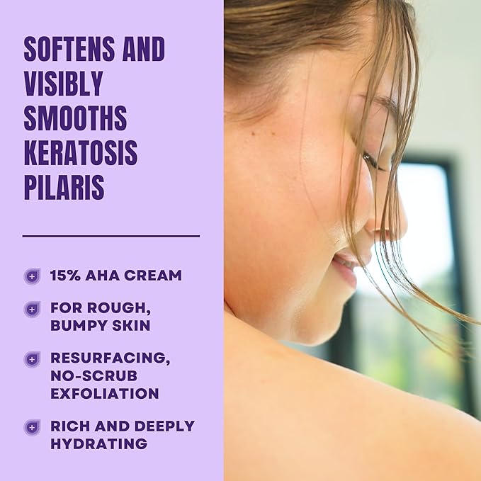 AmLactin KP Bumps Be Gone - 3 oz Keratosis Pilaris Moisturizing Cream with 15% Lactic Acid - Exfoliator and Moisturizer for Dry, Rough and Bumpy Skin, Pack of 2 (Packaging May Vary)