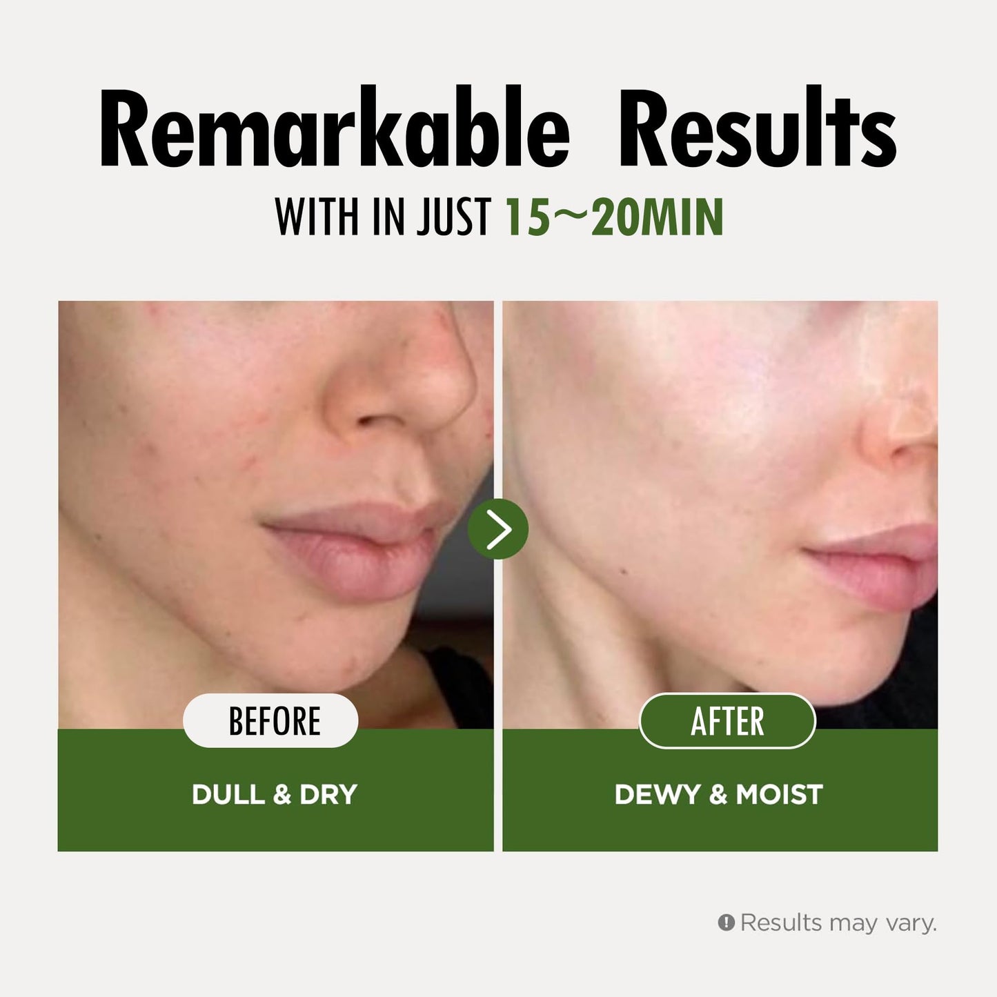 FARMSKIN Superfood Salad Sheet Mask Set of 6 | Korean Face Mask Sheets w/Mangosteen, Broccoli, Carrot, Coconut, Blueberry & Tomato | Refreshing, Nourishing & Cruelty-Free Face Mask Skincare Set