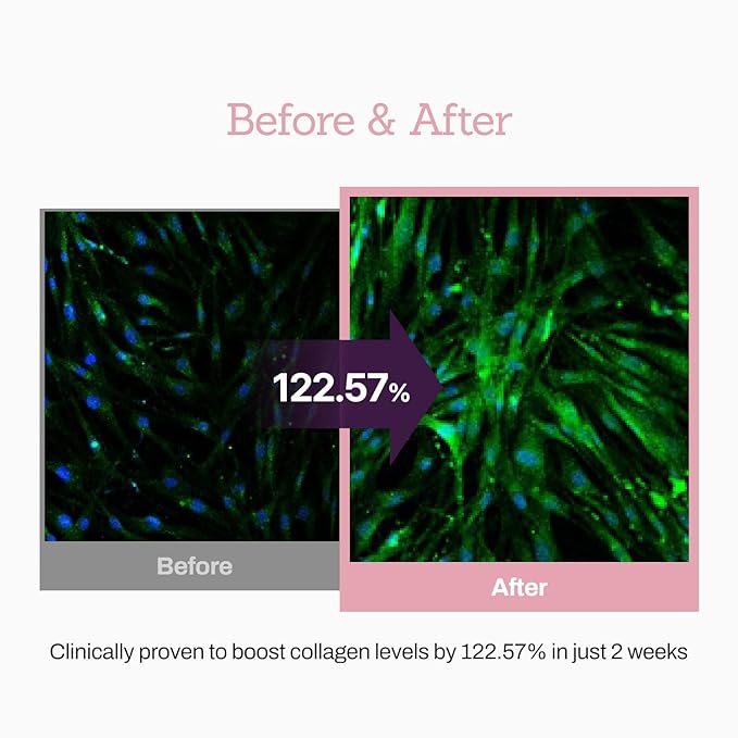 Collagen Peptide 12X Boosting Serum, Enhances Skin Elasticity & Reduces Deep Wrinkles, Promotes Collagen Production for Firm and Youthful Skin, Korean Skincare, 1.01 fl.oz