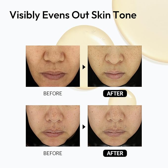 Dark Spot Correcting Serum for Face Korean Skin Care, Layerlab 10% Vitamin C Resveratrol Vitamin E Radiance Smoothing Dull Skin Tone Anti-Aging. Daily Pure Vitamin C 10% Serum 28ml 0.94 fl oz