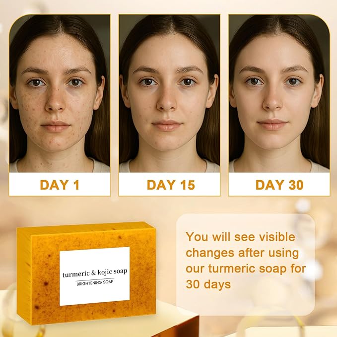 Turmeric Soap for Spots Remover - Honey Lemon Turmeric Kojic Soap Bar for Face and Body, Organic Daily Use Skin Care Soaps, Evens Skin Tone Deep Cleansing Moisturizing (3pcs)