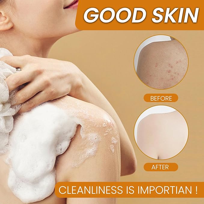 ISILANDON Turmeric and Tea Tree Oil Cleansing Soap Infused with Aloe, Bamboo Charcoal & Nourishing Oils