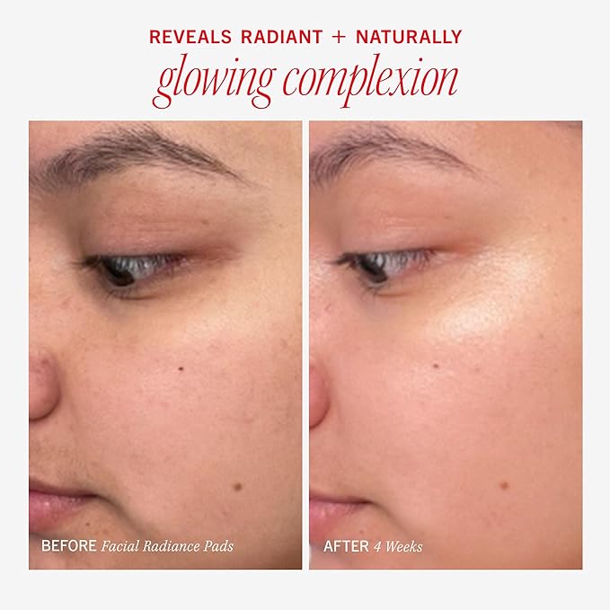 First Aid Beauty - Facial Radiance Pads with Glycolic & Lactic Acids, Daily Exfoliating Pads with AHA that Help Tone & Brighten Skin, Makeup Prep Pads, Compostable for Daily Use, 60 Pads, 2ct