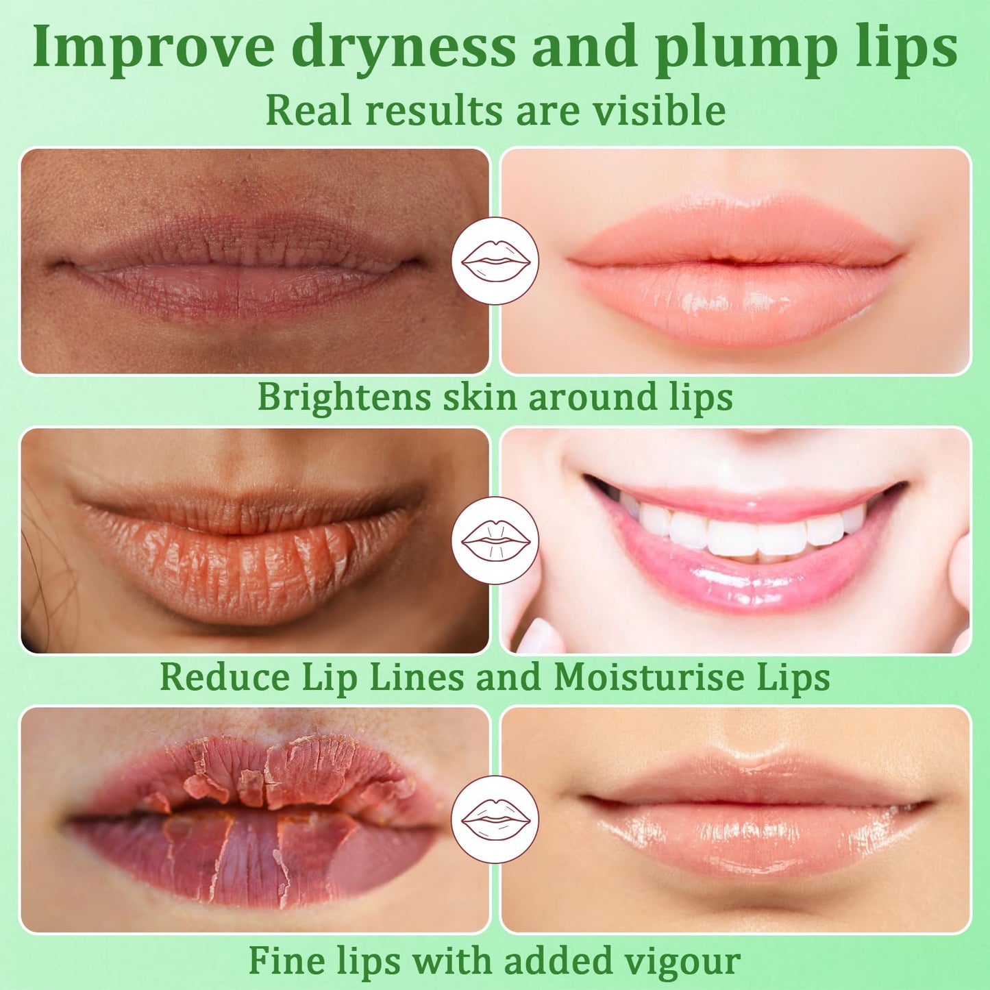 30PCS Moisturizing Lip Mask - Lip Patches for Spa Daily Labial Masks Skincare Hydrating to Reduce Wrinkles Dryness Anti-wrinkle Lightens, Avocado