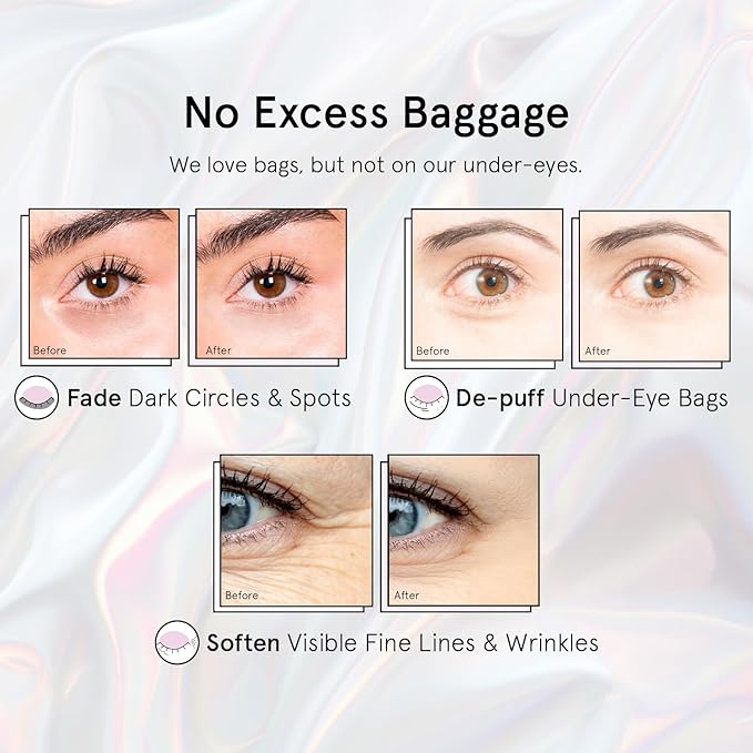 grace & stella Peptide Under Eye Patches with Niacinamide & Rice Extract - Firming Eye Masks for Dark Circles and Puffiness - Gel Mask for Firmer-Looking Skin - Vegan, Cruelty-Free (White, 24 Pairs)