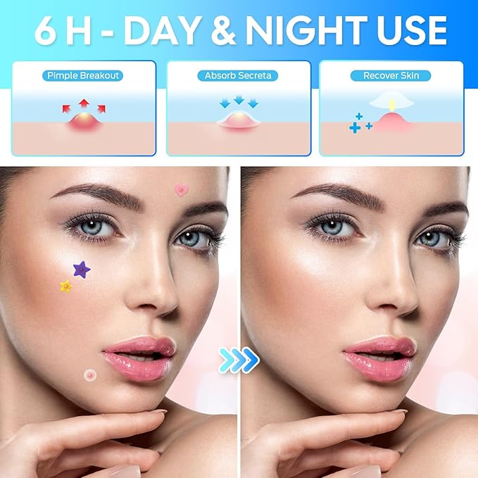 Acne Healing Patch - 306 Hydrocolloid Patches with Natural Ingredients, Fast-Acting Invisible Pimple Care, 3 Shapes & 6 Colors (Black)