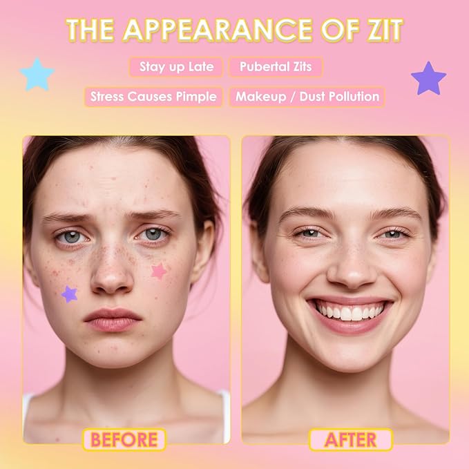 AUSLKA Star Pimple Patches (360 Pcs) Cute Zit Patches for Face, Star Spot Stickers with Salicylic Acid, Hydrocolloid Pimple Patches Absorb Fluid Quickly, Star Blemish Patches for Skin Care, Vegan