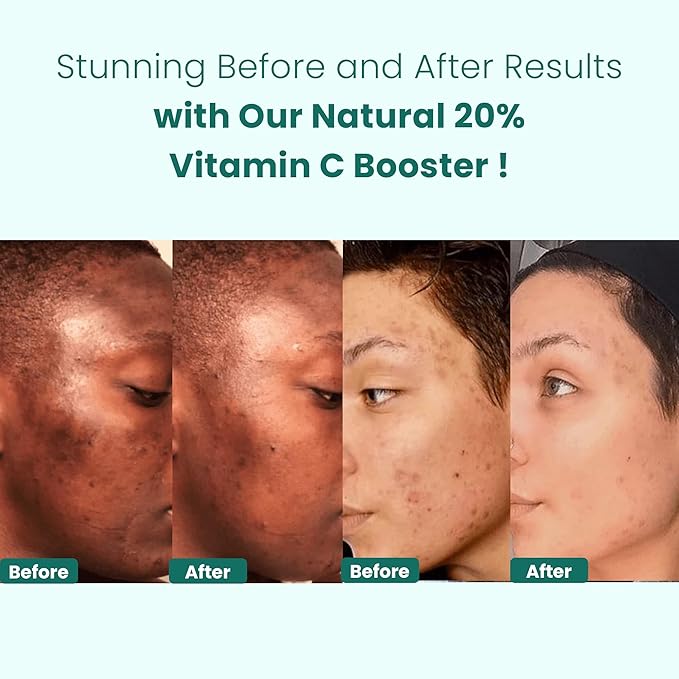 Gin Amber Beauty - Natural 20% Vitamin C Booster - Brightening