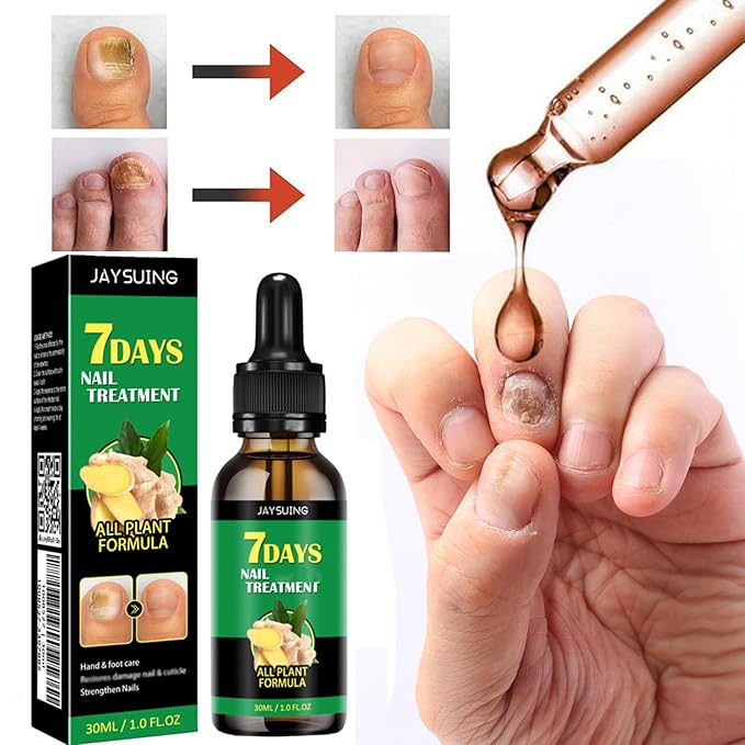 Ginger Nail Treatment Nail Support