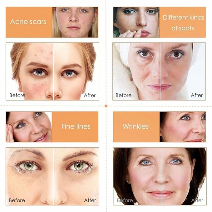 Vitamin C 5-Piece Skincare Set Brightening