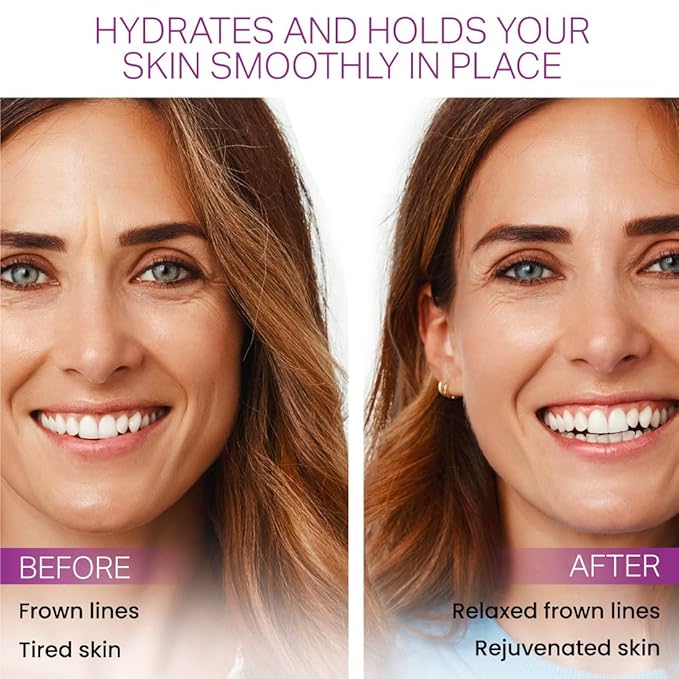 Furlesse Elevens Wrinkle Patches, Overnight Wrinkle Anti-Aging