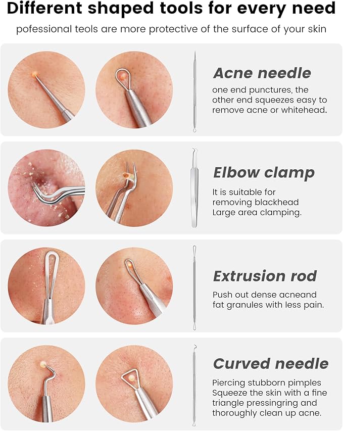 Pimple Popper Tool Kit - Boxoyx 6 Pcs Pore Prep Blackhead Remover Comedone Extractor Kit with Box for Quick and Easy Removal of Pimples, Blackheads, Zit Removing, Forehead,Facial and Nose (Silver)