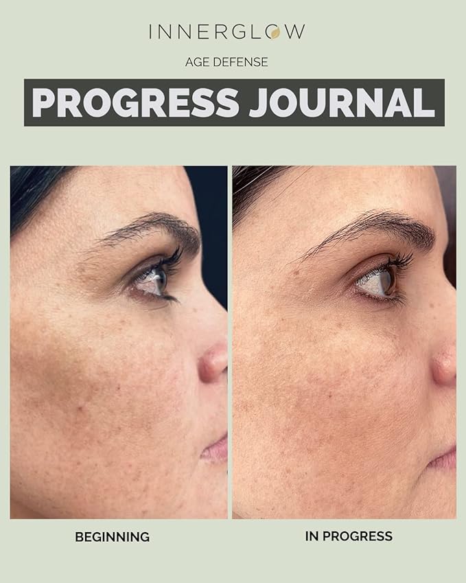 Inner Glow Age Defense Vitamins - Dermatologist and Plastic Surgeon Developed to Fight photoaging and Melasma, Polypodium Leucotomos and Pycnogenol