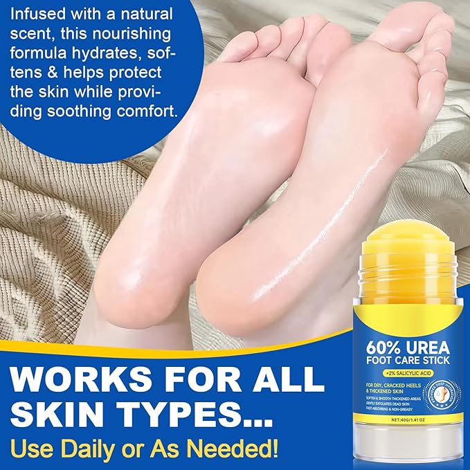 Urea Cream Stick 60% plus 2% Salicylic Acid,urea cream percent for feet maximum strength,Foot Lotion Stick for Cracked Heels,Dry Hands & Rough Knees,Callus Remover & Skin Softener, Soften Dead (1)