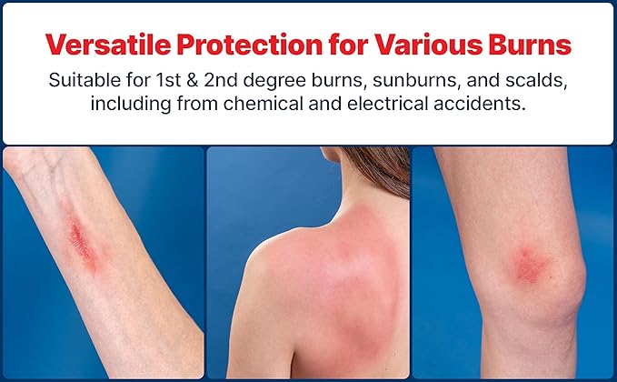 BurnFix® Burn Kit First Aid Recommended by Doctors, Comprehensive 25pcs First Aid Kit Includes First Aid Burn Cream, Burn Dressing, Gloves, Scissors, Wipes Burn Relief - Sunburn, Flame Burn, Burn Care