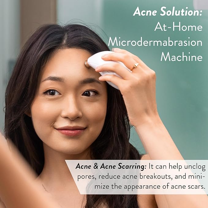 Microderm GLO Diamond Microdermabrasion Machine - Best Gift for Women - Dermabrasion & Anti Aging Wrinkle Skincare - Home Facial Treatment System - Blackhead Remover & Exfoliator for Acne Scars