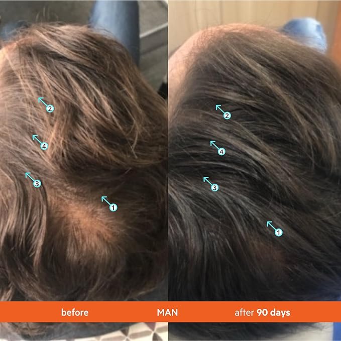 DS Labs Revita Shampoo and Spectral Men's Kit – High-Performance Hair Density Shampoo & Serum Bundle, Volumizing & Thickening, Fuller, Healthier-Looking Hair, Sulfate & Silicone Free, For Men