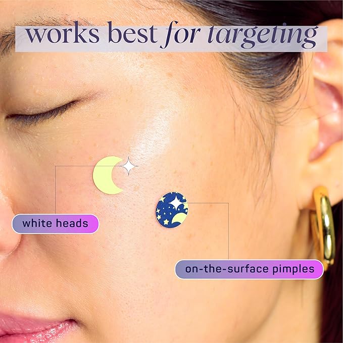 SpaLife Beauty Glow in the Dark Pimple Patches – Hydrocolloid Formula for Acne, Spots, Redness, and Oiliness – 132 Assorted – Acne Patches – Spot Treatment - zit Patches