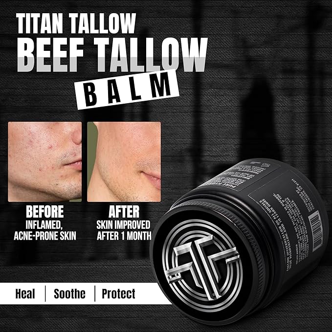Beef Tallow for Skin, Face & Body Balm with Magnesium for Sleep, Leg Cramps & Pain, Muscle Relaxation, Moisturizing Topical Cream - Organic Grass-Fed & Grass-Finished Tallow, Manuka Honey Lotion