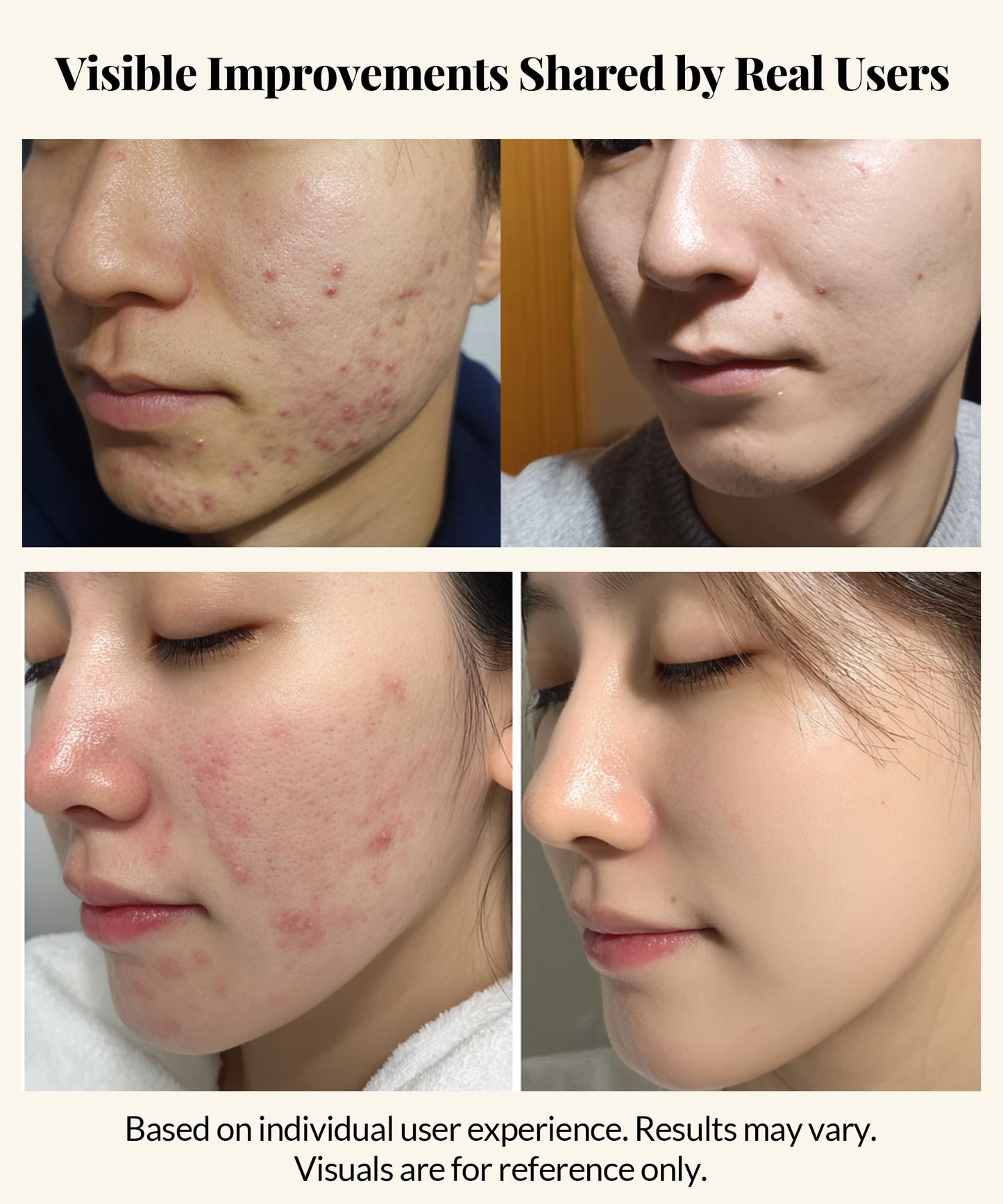 Centella Asiatica Serum Korean - Redness Corrector for Face - 38% Cica Leaf Water and Madecassoside - Ph Balanced - Barrier Support - Lightweight Calming - Rosacea Skincare Serum - Centella Ampoule