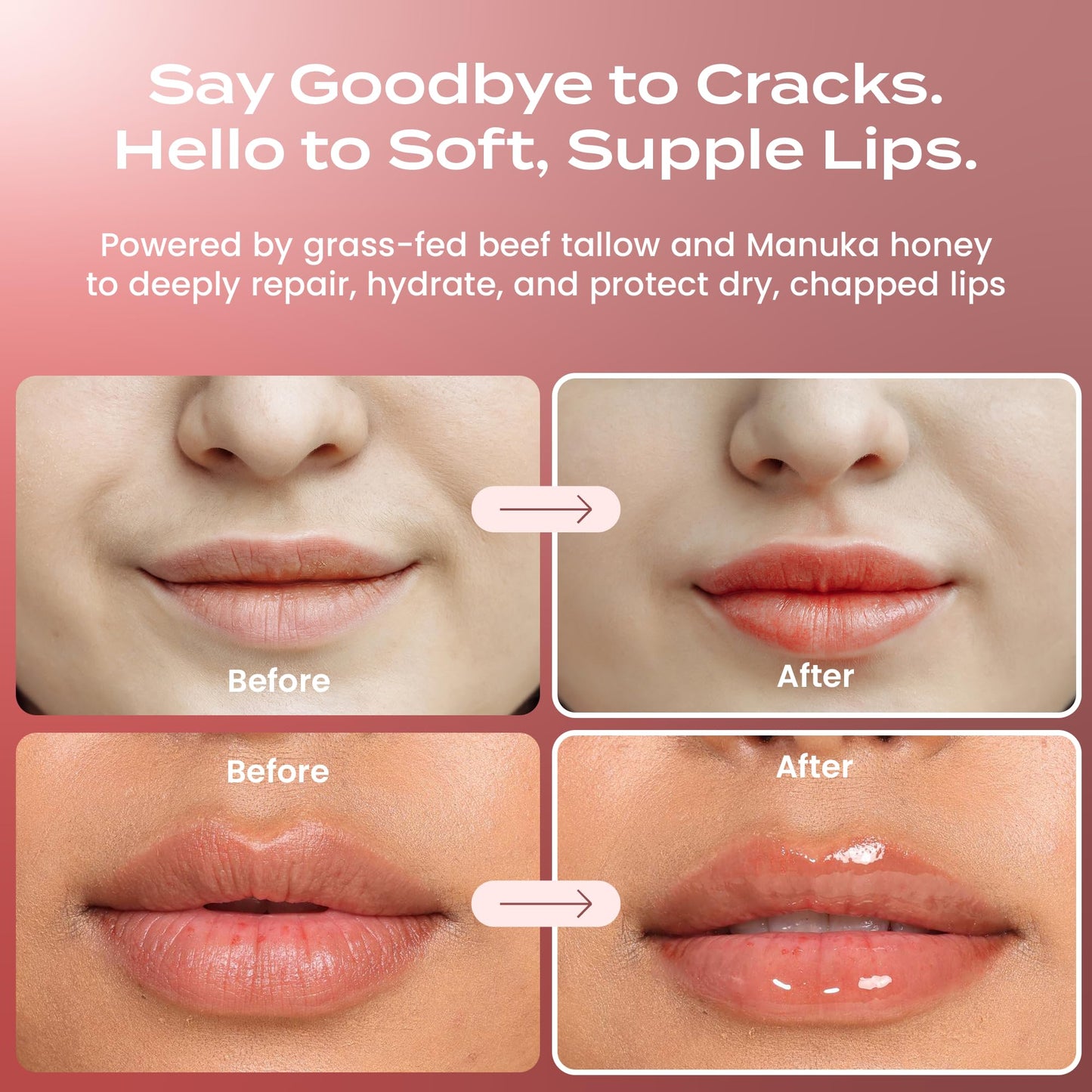 Body Restore Grass Fed Beef Tallow Lip Mask, Manuka Honey – Christmas Stocking Stuffers, White Elephant, Hydrating Moisture, Travel Essentials, Self Care, Birthday Gifts for Women, Men – Unscented