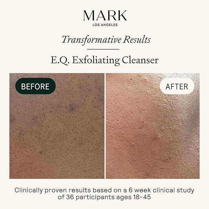 EQ Exfoliating Cleanser | Plant-Based EGCG & Quercetin for Redness, Blemishes & Hydration | Gentle Face & Body Scrub with Squalane Oil & Finely Ground Walnut Shells | Fragrance-Free | 4.05 fl oz