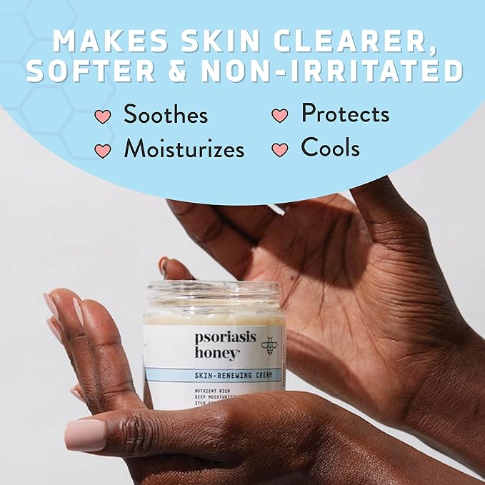 Skin-Renewing Cream - Eczema & Seborrheic Dermatitis Cream - Psoriasis Treatment for Skin, Redness & Itch Relief (4oz)