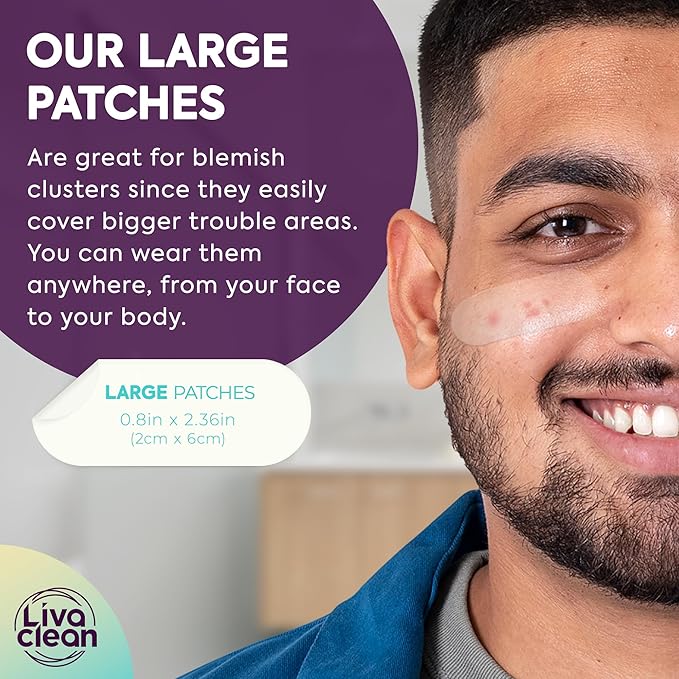 LivaClean LC 𝟏𝟎𝟎 𝐂𝐓, 𝟐 𝐏𝐚𝐜𝐤 Large Hydrocolloid Acne Patches - for Pore Spots Nose Face Cystic Pimple Zit Patch - Big Pimple Patches Hydrocolloid Bandages Strips Stickers Patch XL Large Acne