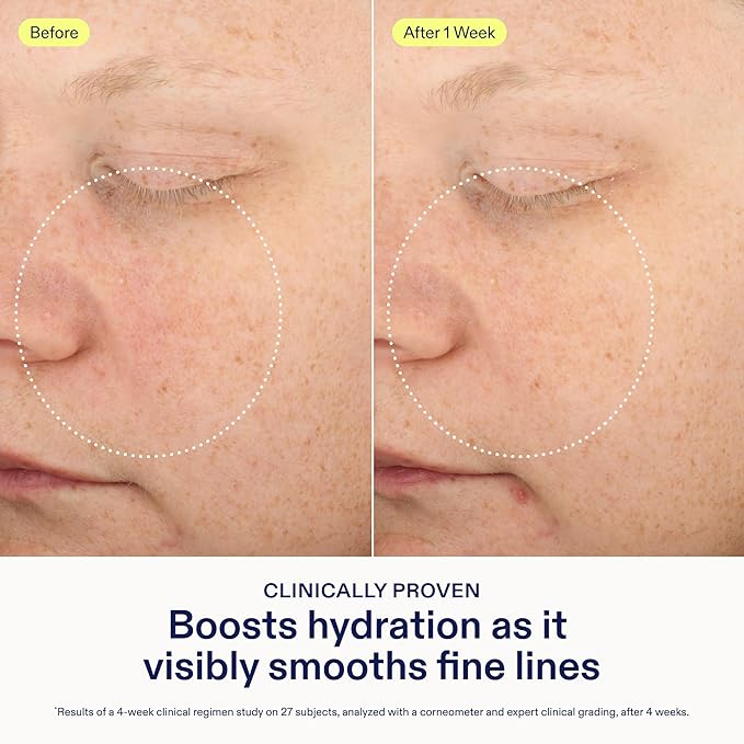 Skinfix Triple Lipid-Peptide Lotion - 1.7 oz - Lightweight, Hydrating Face Moisturizer - Non-Comedogenic - Fragrance Free - Vegan, Cruelty Free