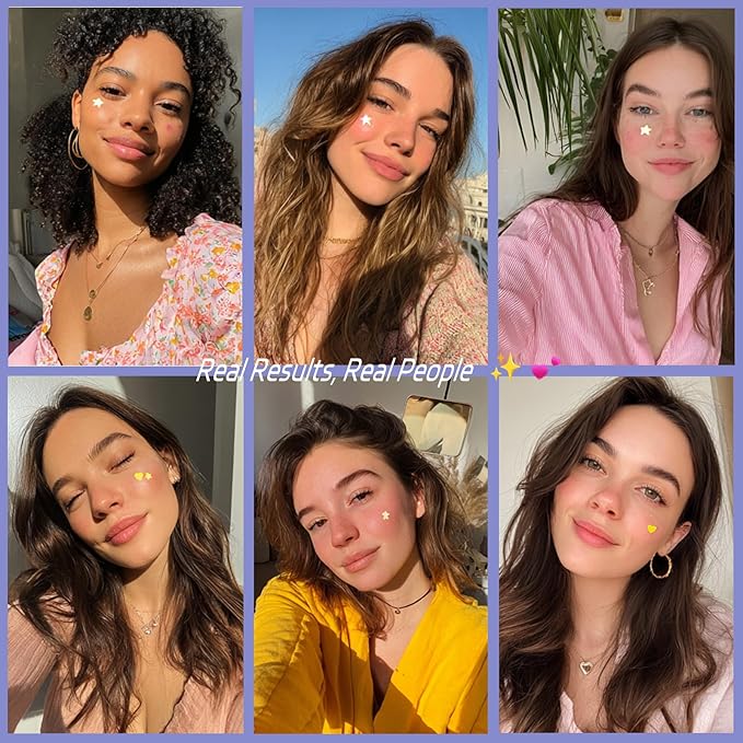 Hydrocolloid Acne Patches – Invisible& Visible Pimple Patches for Face, Tea Tree oil, Zit Absorbing Spot Treatment, Blemish Patches, Patch for Whitehead, Star& Heart Shapes, 180 count