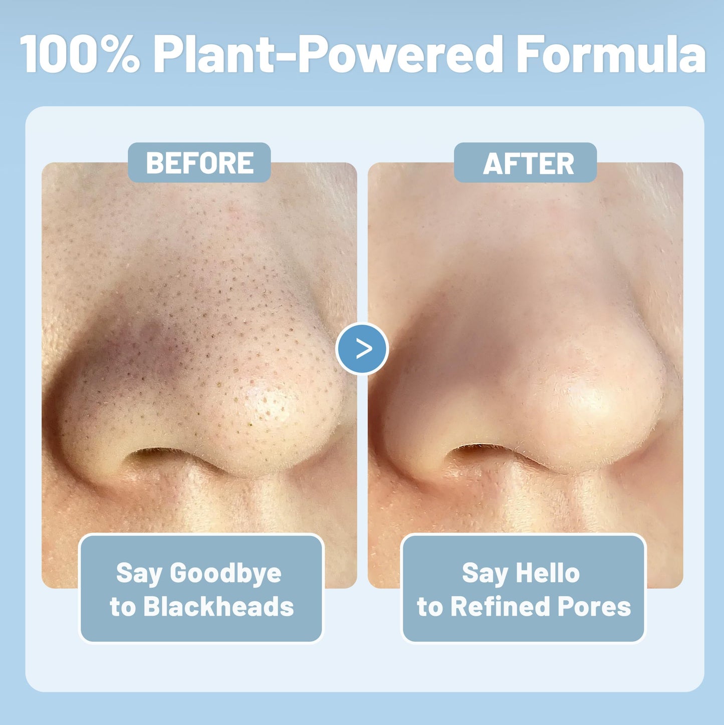 HUGROSE Herbal Blackhead Cleanse Kit Nose Pore Strips, Plant-Powered Deep Cleansing Blackhead Remover Strip Set