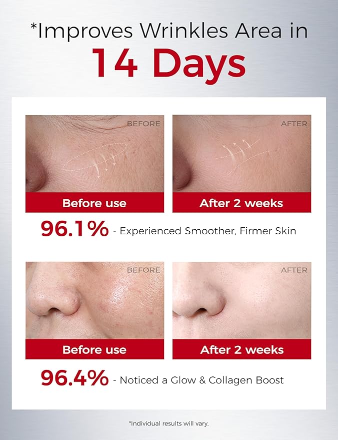 Retinol Serum for Face with Peptides: Anti-Aging, Firming & Wrinkle Repair | Hydrating & Smoothing Face Treatment | Korean Skincare Synergy Formula 1.01oz