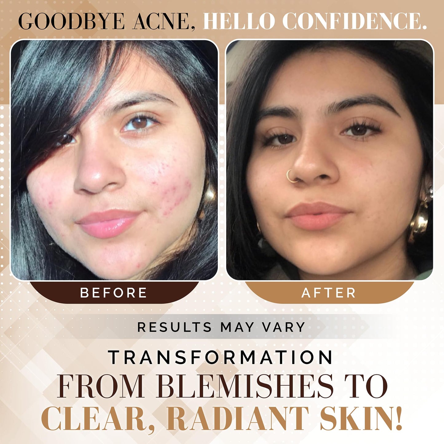 Noir D'or Acne Scar Treatment | Three-Step Extra Gentle Repair Set for Hyperpigmentation, Dark Spot Removal, and Breakouts | Face Skincare