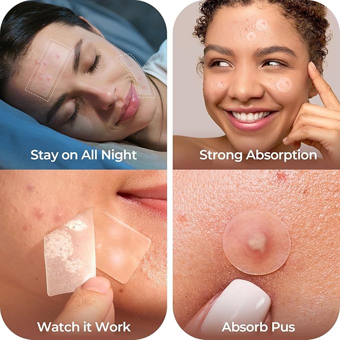LitBear Large Pimple Patches, 5 Sizes 212 Counts Big Acne Patches for Face, Forehead, Body and Back, Hydrocolloid Bandages for Zits, Blemishes and Large Breakouts, Hydrocolloid Patch Pimple Stickers