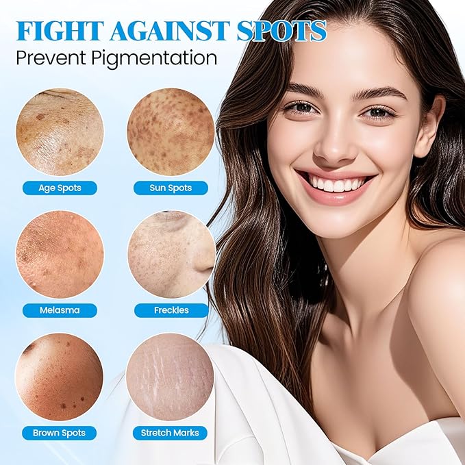 Dark Spot Remover for Face,Dark Spot Corrector, Dark Spot Serum for Sun Spots, Age Spots, Brown Spots,Acne Scars,Melasma Brown Spot -Advanced Formula with Niacinamide Retinol for Women (1.0 Fl Oz)