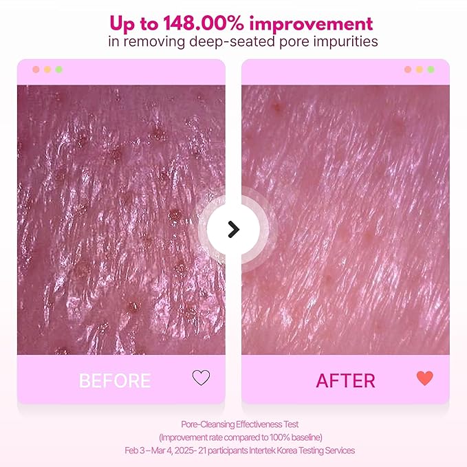 4-in-1 Konjac Jelly Face Cleanser – Gentle Daily Exfoliating, Deep Cleansing, Pore Care & Makeup Removal | Berry Smoothie Texture with Raspberry & Vitamin B+C+E Complex | Dermatologist-Tested