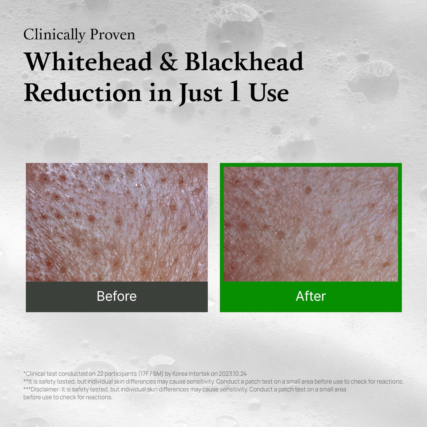 FULLY Green Tomato Pore Detox Clay Mask Cleanser, Pore Minimizing, Blackhead Care, Sebum Control, Exfoliation, Vegan, Face Wash, Sensitive Skin, Korean Skincare 4.05 fl.oz