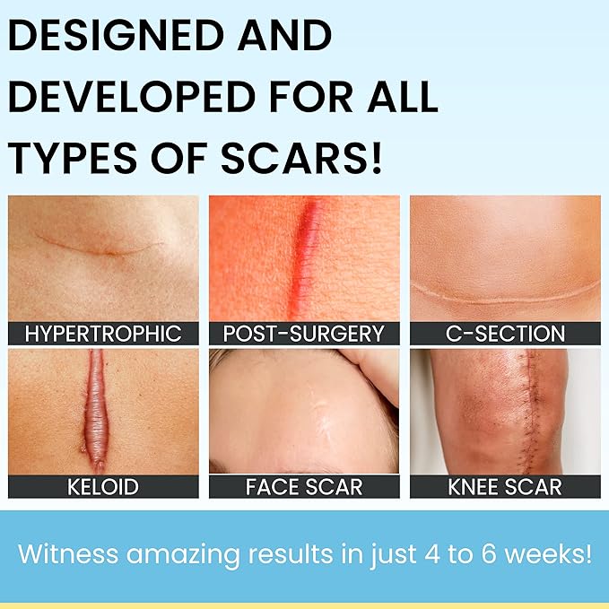 Invisible Brush-On Silicone Sheet with Vitamin E - Scar Removal for Keloids, Burn Scars, Surgery Scars, Stitches, Cuts - No Ugly Scar Sheets, Cream or Messy Scar Gel Needed