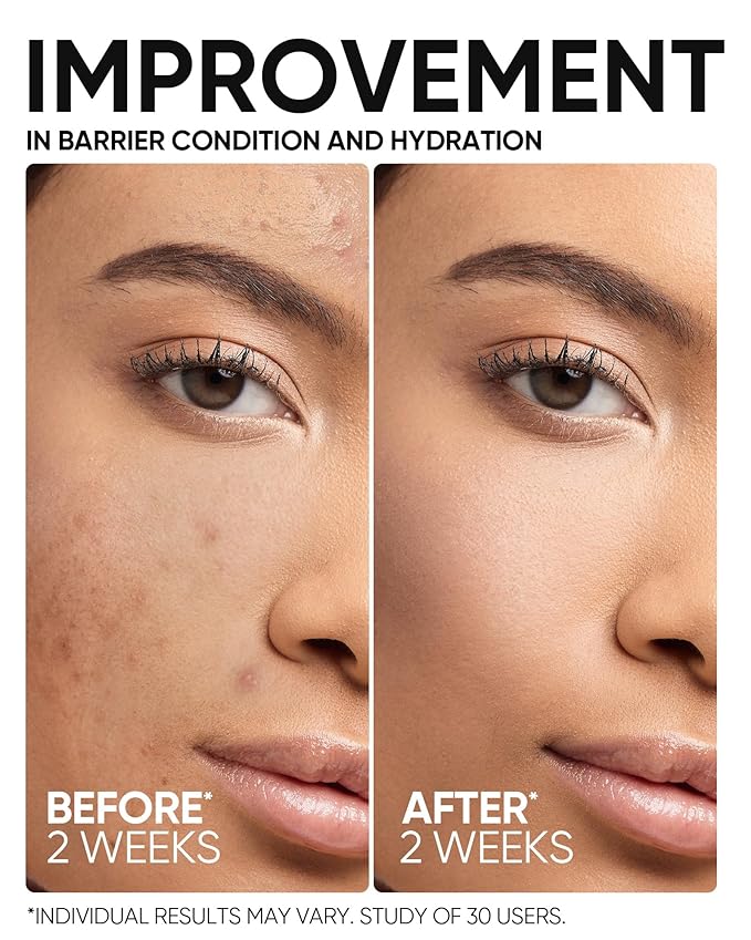 5X Ceramide Barrier Repair Serum for Dry & Sensitive Skin Barrier Repair with Ceramide, Centella and Hyaluronic Acid