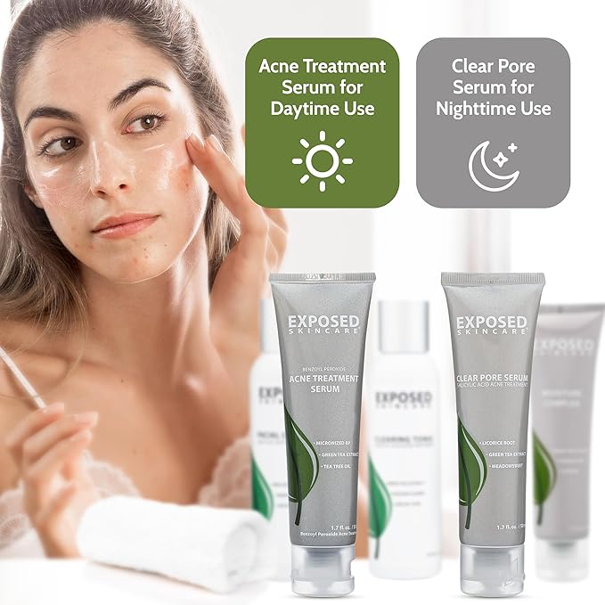 Exposed Skin Care, Expanded Acne Treatment Kit with 2.5% Salicylic Acid and 3.5% Benzoyl Peroxide to Clear Up Teen, Adult, Hormonal and Cystic Acne – Natural, Non-toxic and Cruelty Free