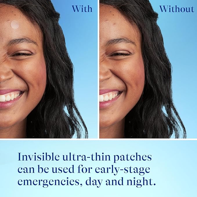 Differin Acne Patches, Pimple Patches for Acne Prone Skin, Formulated with Salicylic Acid and Centella, Fast Triple Action Power Patch for Day & Night, Dermatologist Tested, 36 Count