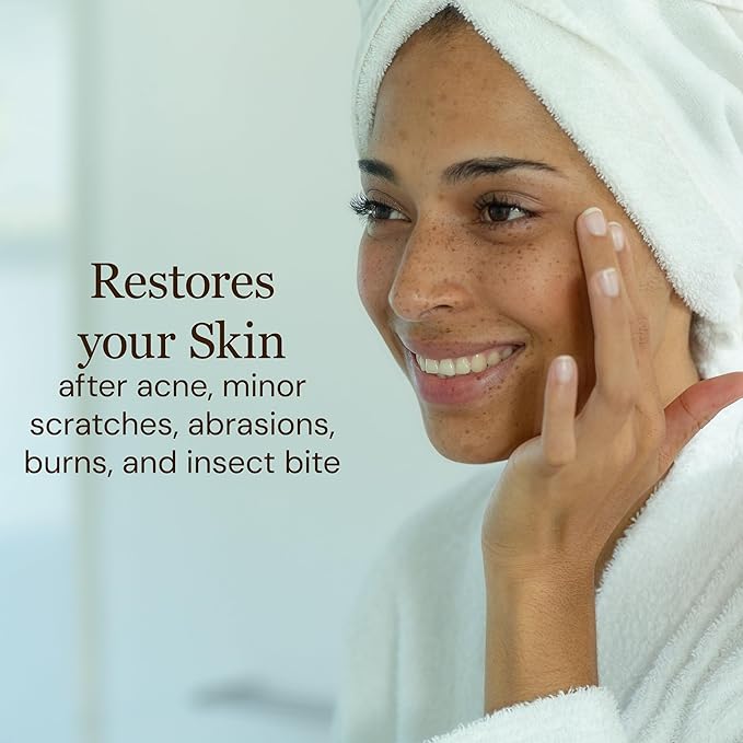 Sea Buckthorn Healing Lotion, 4oz – Soothing Moisturizer with MSM, Black Willow Bark & Zinc Oxide – Organic, Vegan – Repairs Acne, Redness & Skin Irritation