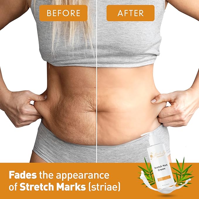 Stretch Mark Cream, Belly Butter & ML