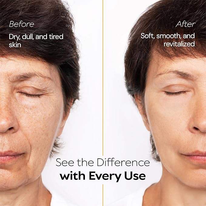 Beef Tallow for Skin, Grass-Fed Tallow Face Cream with Hyaluronic Acid, Aloe Vera & Frankincense, Non-Greasy Anti-Aging Moisturizer, Citrus Scent, 2 oz