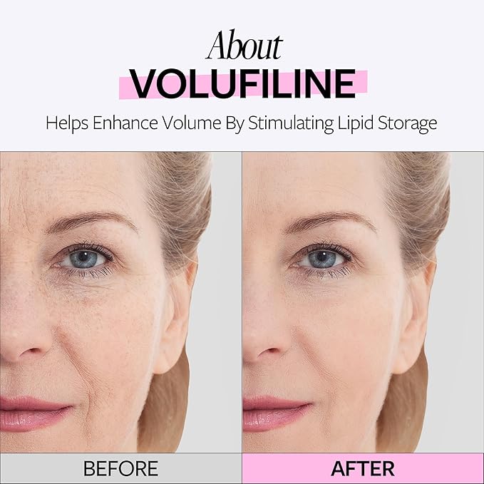 RECIPE Volufiline 100% Ampoule - From France, Sederma - Pure Volufiline Serum - DIY Skin Care Booster for Face & Body – Hydrating & Age-Defying Formula for Elevated Resilience (0.33 fl oz)