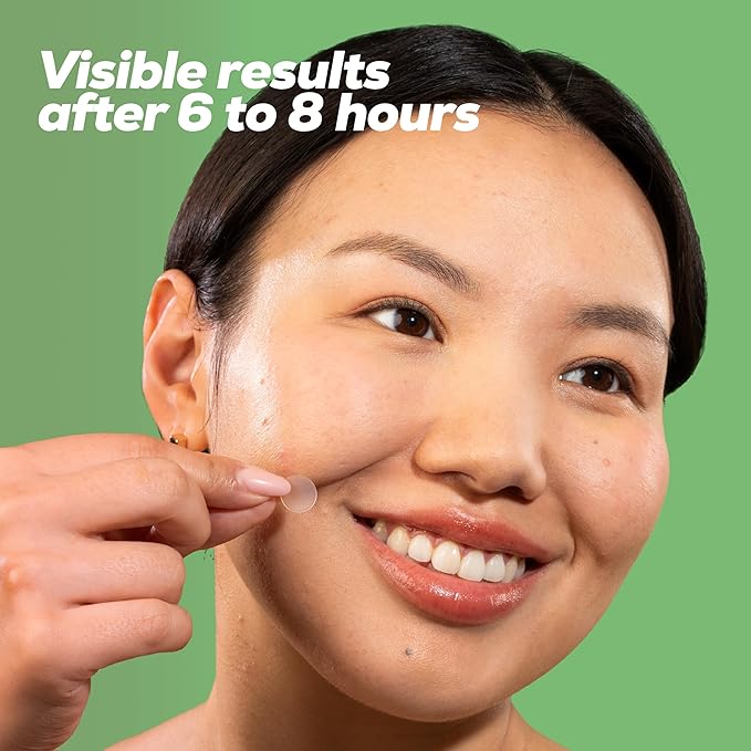 HANHOO Soothing Blemish Patch with Aloe, Madecassic Acid, and Tea Tree Extract | Hydrocolloid Spot Treatment | Calms Pre-stage, Irritated, and Popped Blemishes 108 count